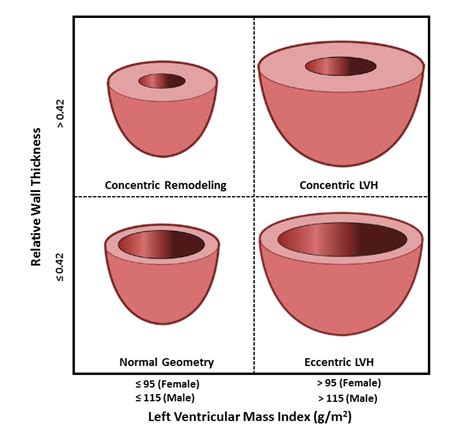 left ventricular hypertrophy wall thickness